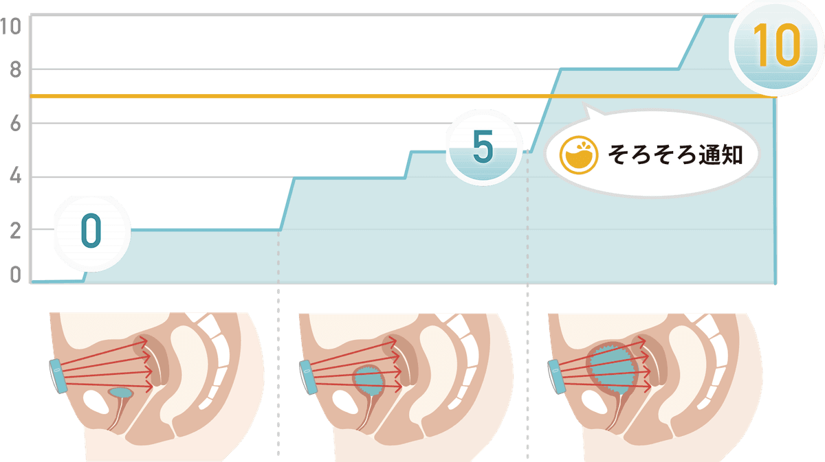 センサー部の超音波